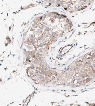 KLHL12/C3IP1 Antibody - BSA Free
