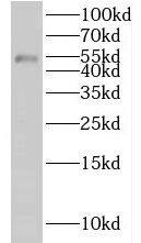 KLHDC3 Antibody - BSA Free