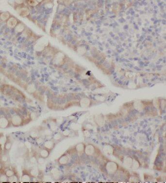 KCNJ13 Antibody - BSA Free