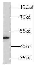 Kir6.2 Antibody - BSA Free