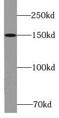 KIF7 Antibody - BSA Free