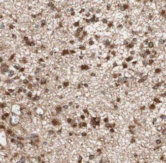 Kif3c Antibody - BSA Free