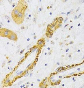 KIF1B Antibody - BSA Free