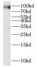 KIF19 Antibody - BSA Free