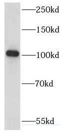 KIF18A Antibody - BSA Free