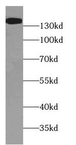 WASHC4 Antibody - BSA Free
