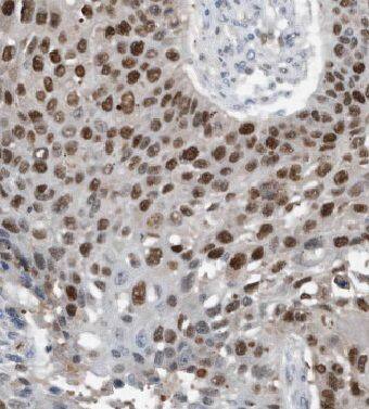 KHDC4 Antibody - BSA Free