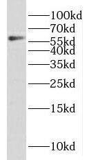 KIAA0895 Antibody - BSA Free