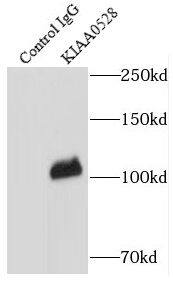 C2CD5 Antibody - BSA Free