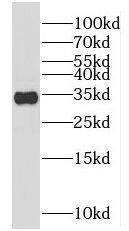 KIAA0513 Antibody - BSA Free