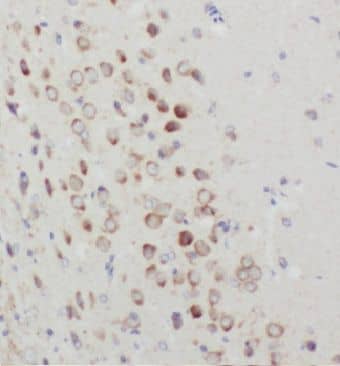AAVR/KIAA0319L Antibody - BSA Free