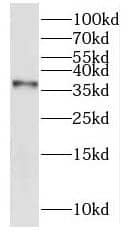 KHDC1 Antibody - BSA Free