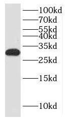 KCTD14 Antibody - BSA Free
