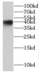KCTD12 Antibody - BSA Free