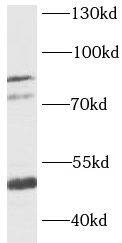 KCNN3 Antibody - BSA Free