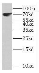 KCNN1 Antibody - BSA Free