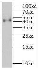 KCNK18 Antibody - BSA Free