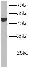 Kir3.4 Antibody - BSA Free