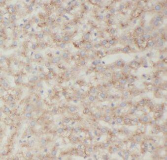 KCNJ15 Antibody - BSA Free