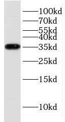 KCNJ15 Antibody - BSA Free
