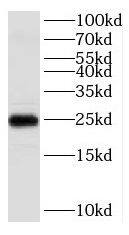 VABP Antibody - BSA Free