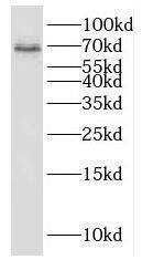 KvBeta1 Antibody - BSA Free