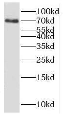 KBTBD5 Antibody - BSA Free