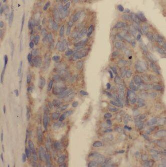 KBTBD2 Antibody - BSA Free