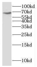 KBTBD2 Antibody - BSA Free