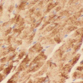 KBTBD10 Antibody - BSA Free