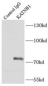 katanin-p80 Antibody - BSA Free