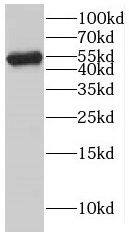 KATNAL1 Antibody - BSA Free