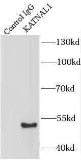 KATNAL1 Antibody - BSA Free