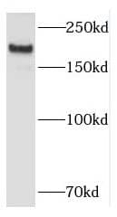 KALRN Antibody - BSA Free