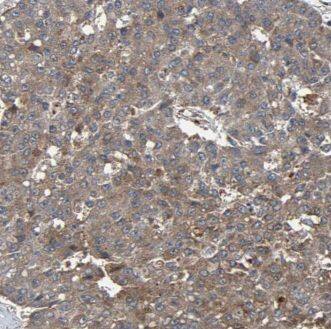 JPH2 Antibody - BSA Free