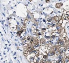 JSRP1 Antibody - BSA Free