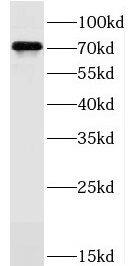 JAKMIP1 Antibody - BSA Free