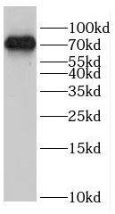 NS1-BP Antibody - BSA Free