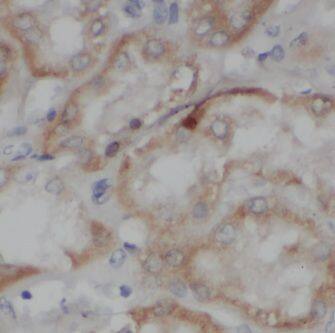 NS1-BP Antibody - BSA Free