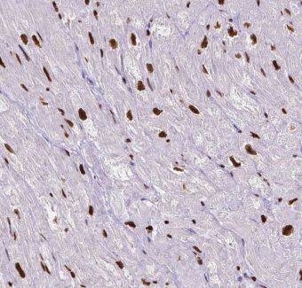 IP3KC Antibody - BSA Free