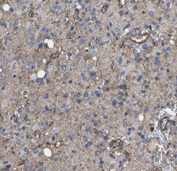 ITPKA Antibody - BSA Free