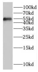 ITPKA Antibody - BSA Free