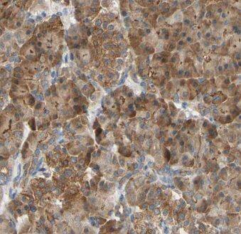 ISYNA1 Antibody - BSA Free