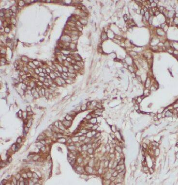 IQCK Antibody - BSA Free