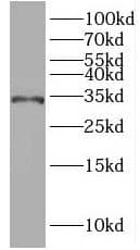 IQCK Antibody - BSA Free