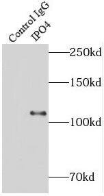 Importin4 Antibody - BSA Free