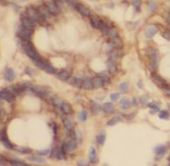 PLA2G6 Antibody - BSA Free