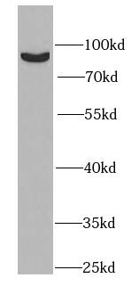 PLA2G6 Antibody - BSA Free