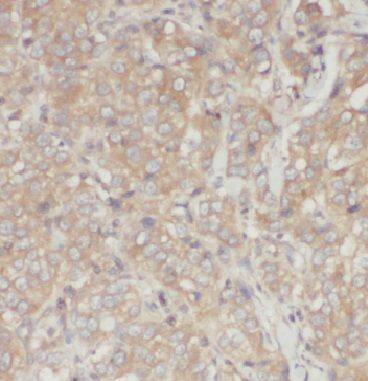 Inversin Antibody - BSA Free