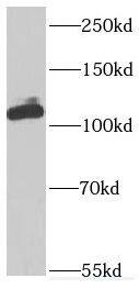 Inversin Antibody - BSA Free